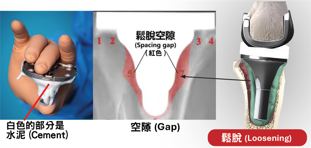 Cement Gap Diagram